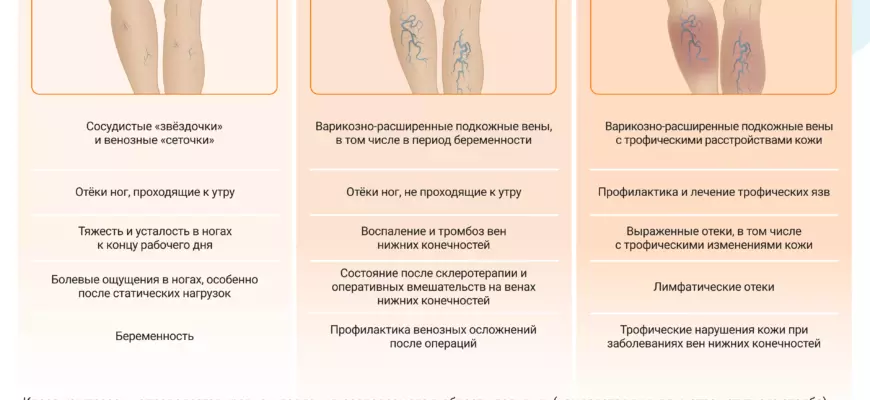 Как выбрать компрессионные гольфы